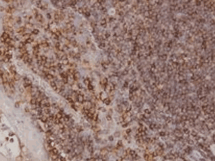 Human ARRB2 Monoclonal Antibody