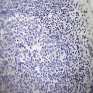 Human ATP1A3 Monoclonal Antibody