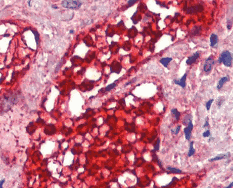Human CA1 Monoclonal Antibody