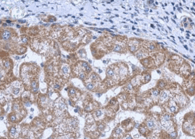 Human BRCA2 Monoclonal Antibody