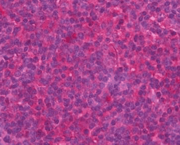 Human CCL5 Monoclonal Antibody