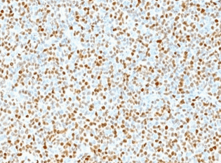 Human CCND1 Monoclonal Antibody