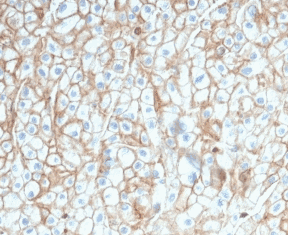 Human CD274 Monoclonal Antibody