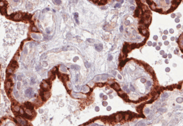 Human GDF15 Monoclonal Antibody