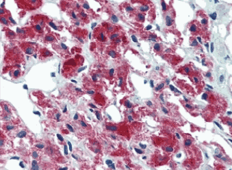 Human IL23A Monoclonal Antibody