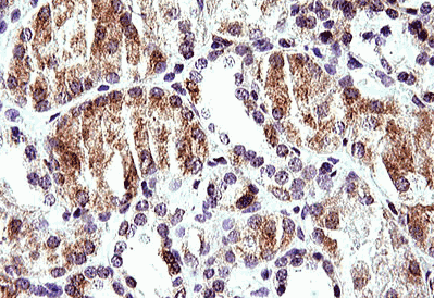 Human HERPUD1 Monoclonal Antibody