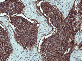 Human IL1A Monoclonal Antibody