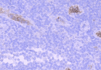 Human HBG1 Monoclonal Antibody