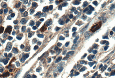 Human IL36B Monoclonal Antibody