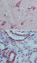 Human IL22 Monoclonal Antibody