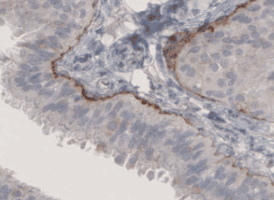Human LAMB3 Monoclonal Antibody