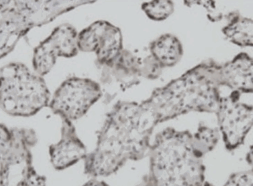 Human S100A11 Monoclonal Antibody