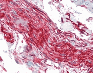 Human S100A10 Monoclonal Antibody