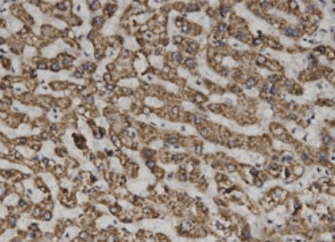Human SEPTIN6 Monoclonal Antibody