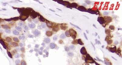 Human MAGEA1 Polyclonal Antibody