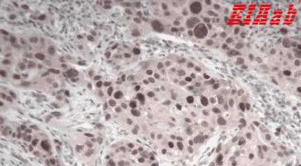 Human MAPK3 Polyclonal Antibody
