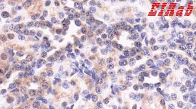 Human MAS1 Polyclonal Antibody