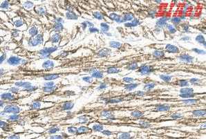 Human MBNL1 Polyclonal Antibody