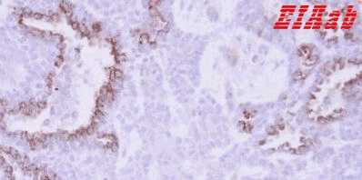 Human MCL1 Polyclonal Antibody