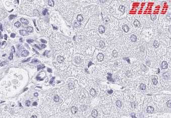 Human MEP1B Polyclonal Antibody
