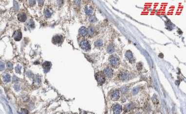 Human MMEL1 Polyclonal Antibody