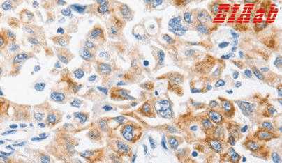 Human MMP10 Polyclonal Antibody