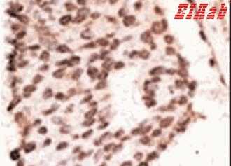 Human MMP7 Polyclonal Antibody