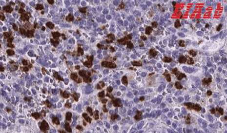 Human MMP9 Polyclonal Antibody