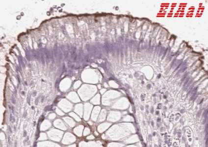 Human MUC12 Polyclonal Antibody