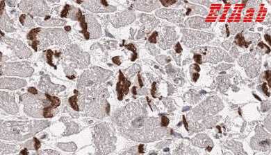 Human PWWP3A Polyclonal Antibody