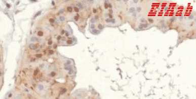 Human MYC Polyclonal Antibody