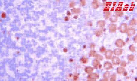 Human NDN Polyclonal Antibody