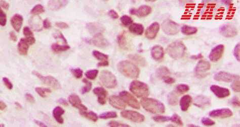 Human NEIL3 Polyclonal Antibody