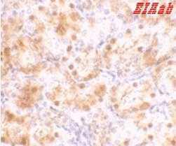 Human NENF Polyclonal Antibody