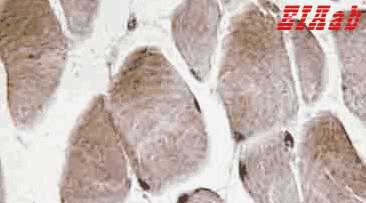 Human NMU Polyclonal Antibody