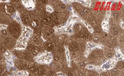Human NNMT Polyclonal Antibody
