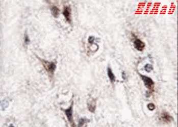 Human NR4A2 Polyclonal Antibody