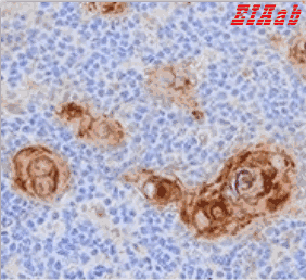 Human TNFSF8 Polyclonal Antibody