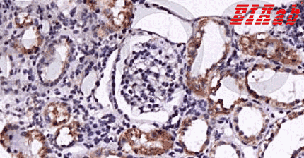 Human KIT Polyclonal Antibody