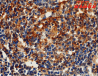 Human TNFRSF1B Polyclonal Antibody