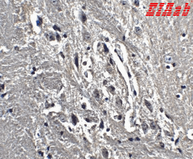Human KIF5A Polyclonal Antibody