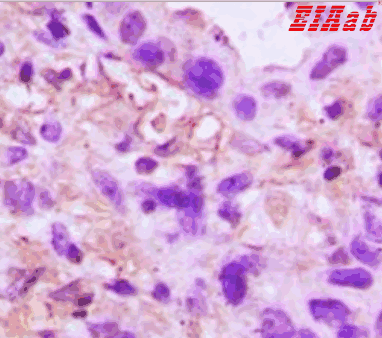 Human TNFAIP6 Polyclonal Antibody