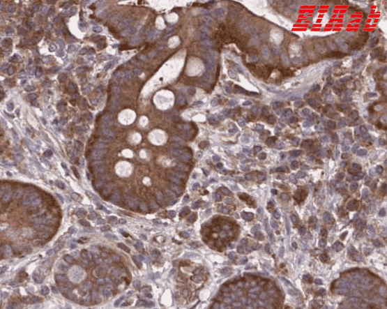 Human ALDH16A1 Polyclonal Antibody
