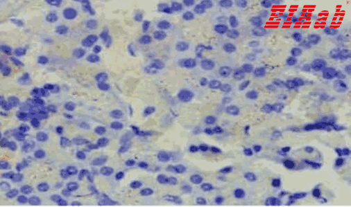 Human LGR4 Polyclonal Antibody