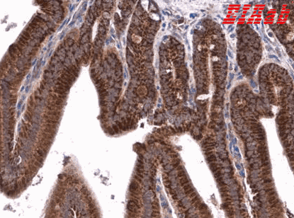 Human ATP5PF Polyclonal Antibody