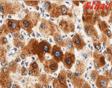 Human UGT1A1 Polyclonal Antibody
