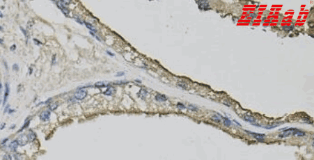 Human LCN1 Polyclonal Antibody