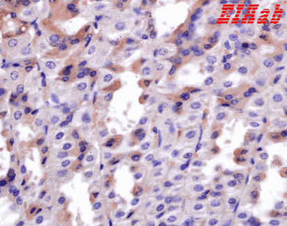 Human ADAM28 Polyclonal Antibody
