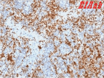 Human ITGB3 Polyclonal Antibody