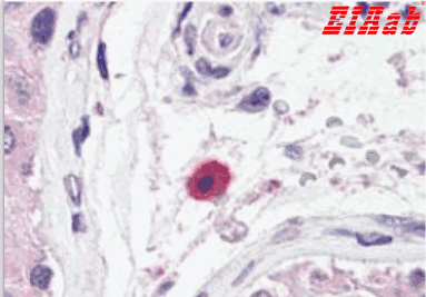 Human TNFRSF13B Polyclonal Antibody